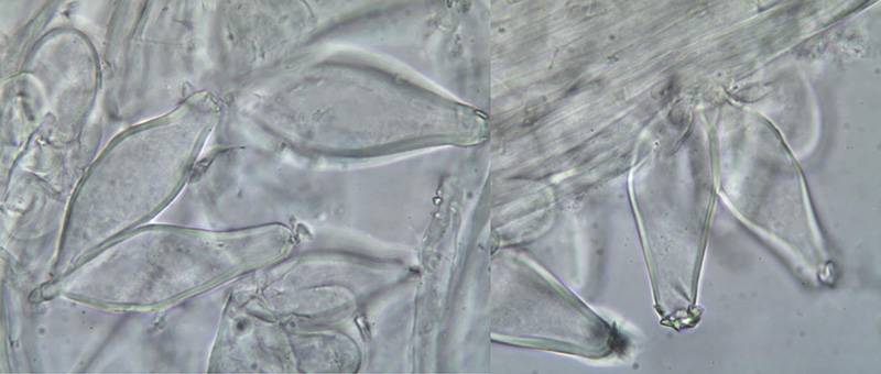 Inocybe metrodii kaulocystidy